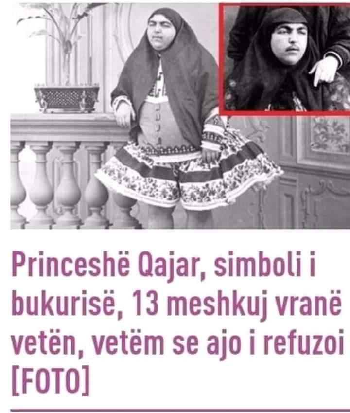 Kujdes Çuna!!! Bukuri që vret!
