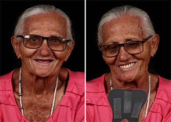 Stomatologu brazilian u ridhuron buzëqeshjen  njerëzve të varfër. Ja edhe 30 fotot.